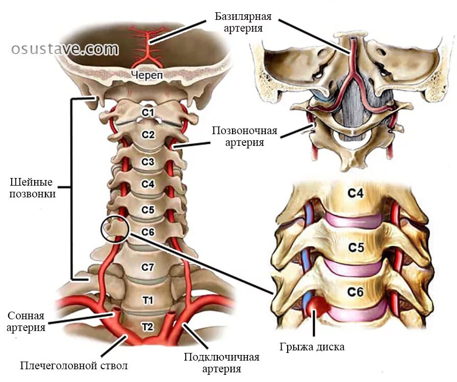 Вбн диагноз в неврологии что. 3 И 4 шейные позвонки. С4 с5 шейные позвонки. Синдром позвоночной артерии с4. Шейный отдел позвоночника с3 с4 с5 с6.