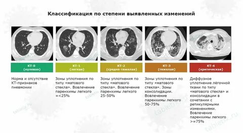 Ковид xec симптомы