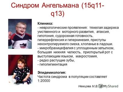 Синдром появления