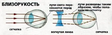 Зрение 60
