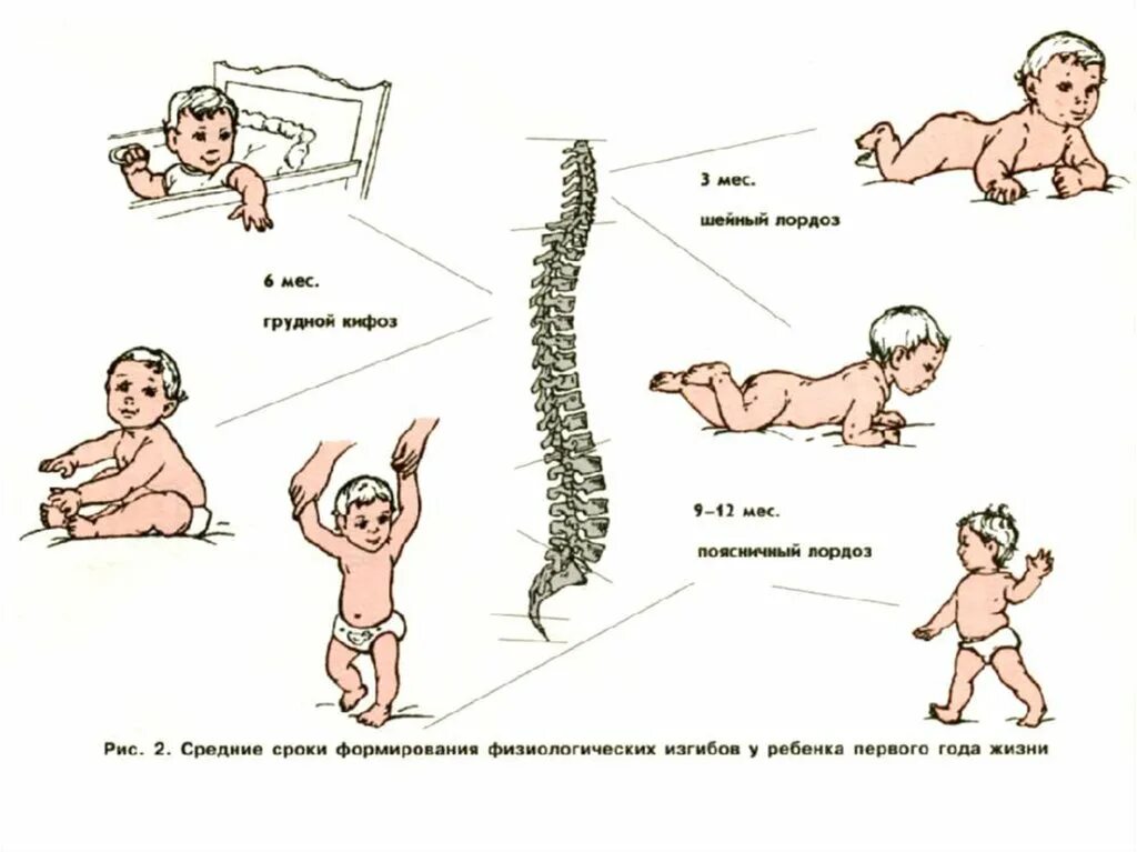 Позвоночник новорожденного. Формирование позвоночника у детей. Изгибы позвоночника у новорожденного. Формирование физиологических изгибов позвоночника.