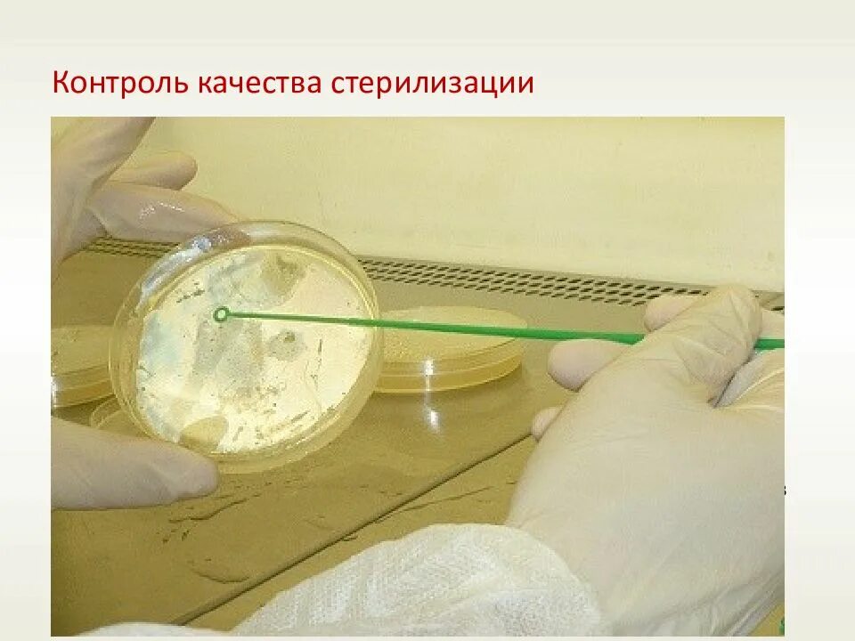 Бактериологический метод стерилизации. Контроль стерильности микробиология. контроль за качеством стерилизации. контроль качества стерилизации индикаторы стерильности.