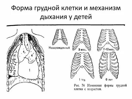 К патологическому типу грудной клетки относится