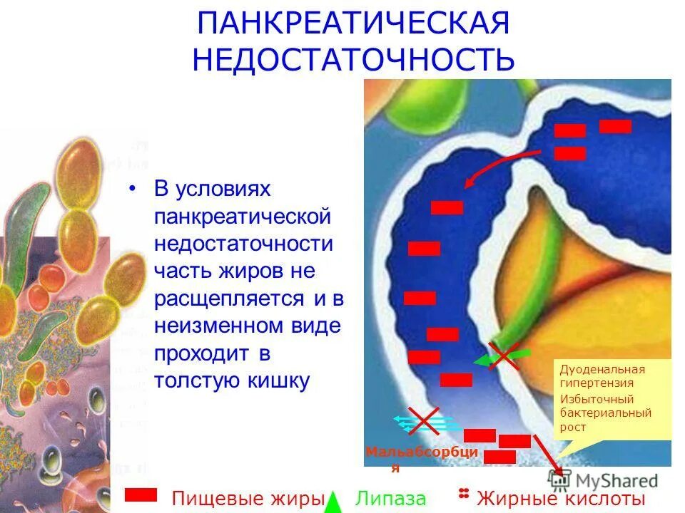 Функции толстого кишечника физиология. Цистолиты характерны для семейства. Расщепление волокон растительной клетчатки в толстом кишечнике. Функции тонкой кишки егэ. Клетчатка расщепляется в толстом кишечнике.