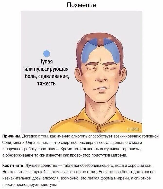 Сильная боль в лобной части. Типы головной боли. Головная боль локализация. Боль в висках головы. Причины головной боли.