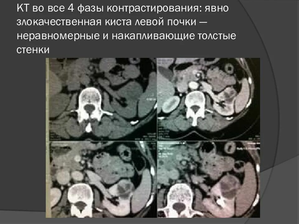 Фазы кт