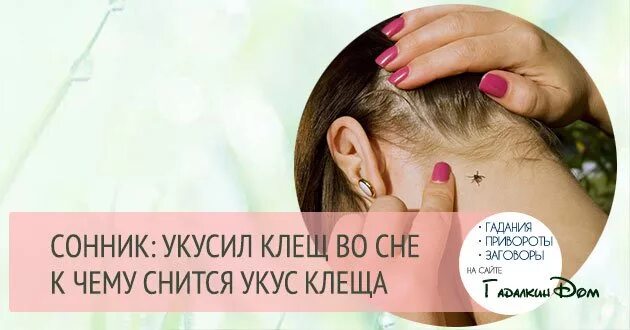 Укусить человека во сне. К чему снится укус клеща. Клещ во сне к чему снится. К чему снится укусы клещей.