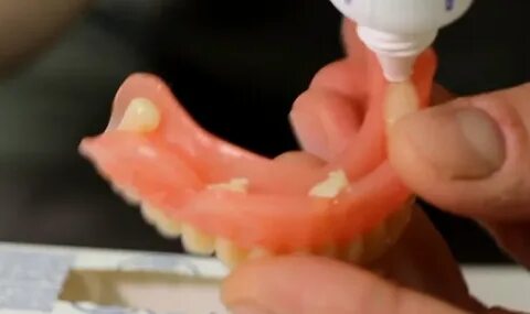 Фиксация протеза какой лучше