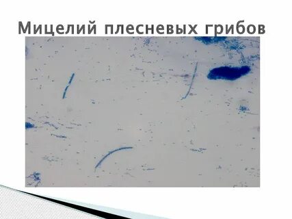 Мицелий в мазке