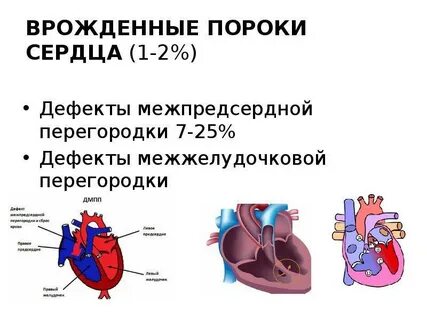 Впс 1
