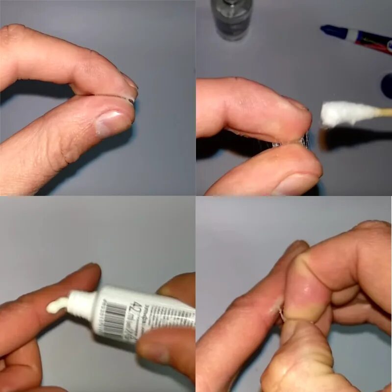 Клей супер. Медицинский супер клей для кожи. Как отмыть суперклей от пальцев. Суперклей попал. Супер клей в тюбике.