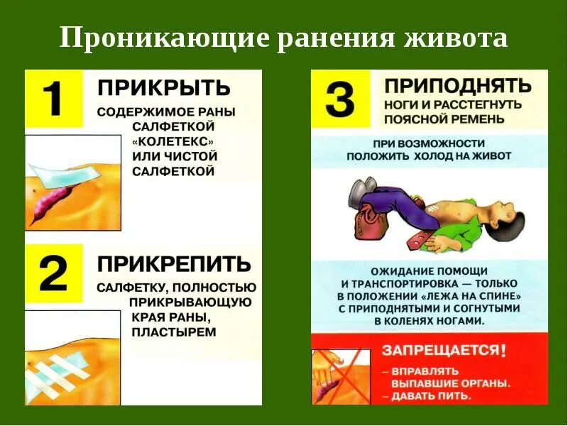 Первая помощь при проникающем ранении брюшной полости. Первая помощь при проникающем ранении живота. Алгоритм действий при проникающих ранениях брюшной полости. Последовательность оказания первой помощи при ранении живота. Проникающее ранение живота это