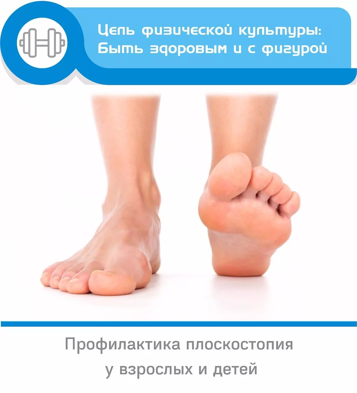 Плоскостопие у взрослых. Степень плоскостопия 2 степень. Выявление плоскостопия. Продольное плоскостопие 2-3 степени у детей. Плоскостопие 1 2 3 степени.