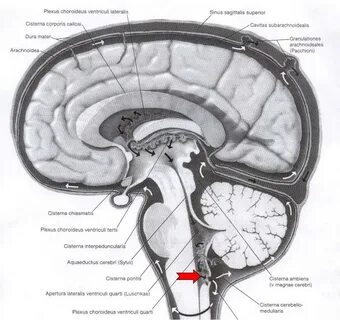 Цистерны головного мозга