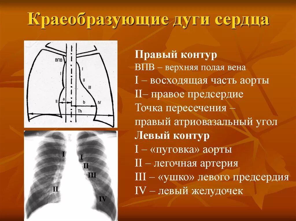 В обеих репликах. Контуры сердца рентген. Дуги сердца на рентгенограмме. Сердечные дуги на рентгенограмме. Дуги сердца на рентгене.