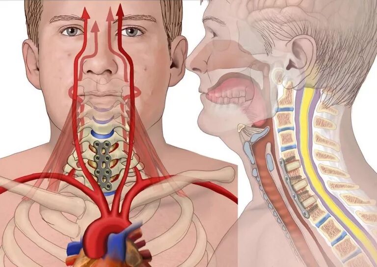 Нарушение кровообращения в шейном отделе. Шея нарушение кровоснабжения. Нарушение кровообращения в шейном отделе симптомы.