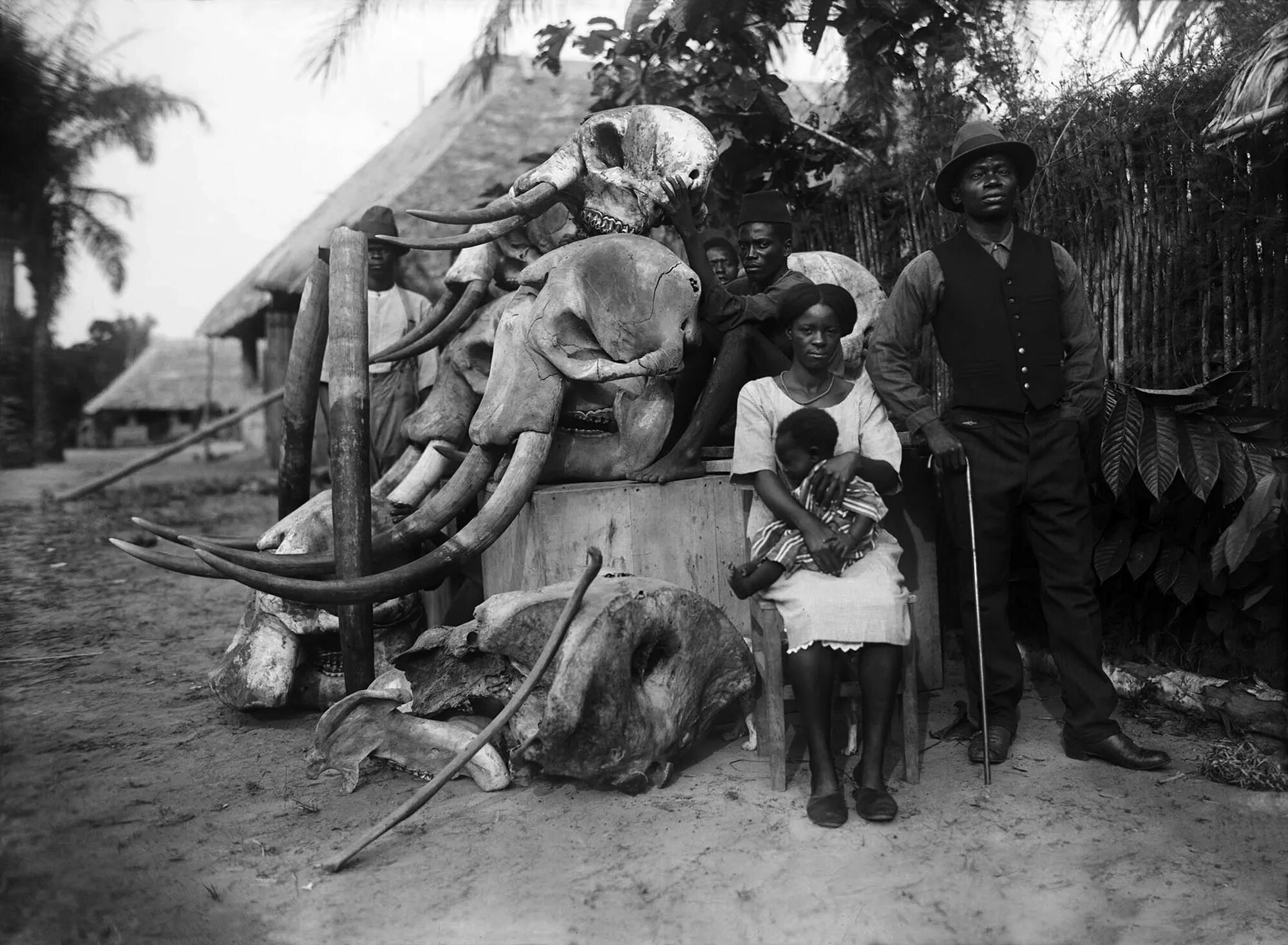 Бельгийская колонизация Конго. Зверства бельгийцев в Конго. Бельгийское Конго дети.