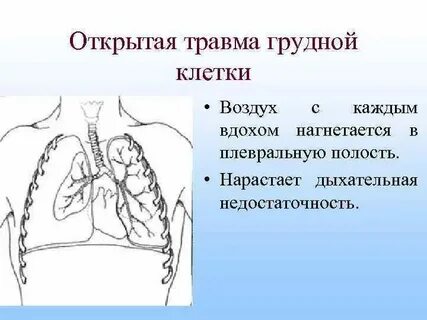 Повреждение органов грудной клетки