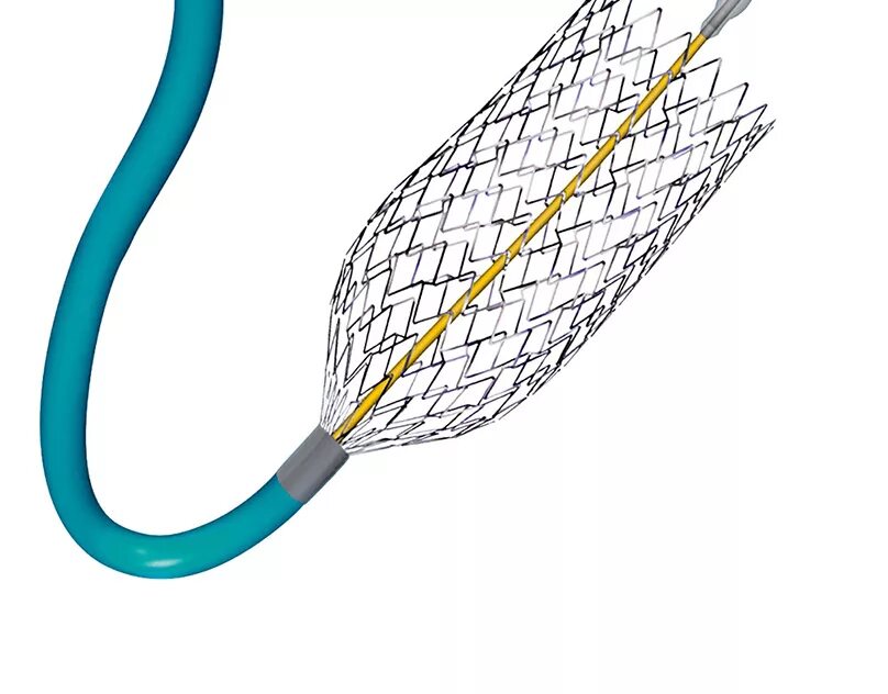 Стент скаффолд (bvs). Стент biomime 1434. Саморасширяющийся стент. Стент феил. Стент феил.