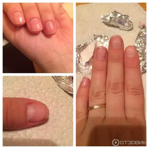 Укрепление ногтей. Ногти до и после маникюра. Можно ли использовать лак после. Можно ли использовать лак после. Можно ли использовать лак после.