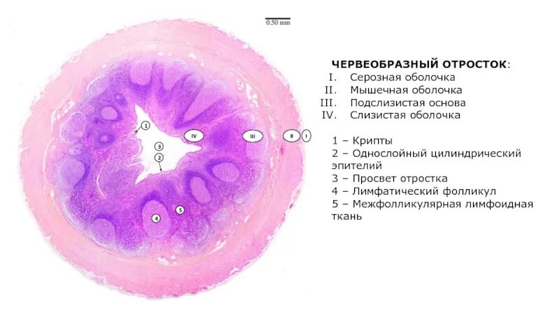 Серозная и слизистая оболочка. Червеобразный отросток гистология препарат. Эпителий червеобразного отростка. Эпителий слизистой оболочки червеобразного отростка. Эпителий серозных оболочек.