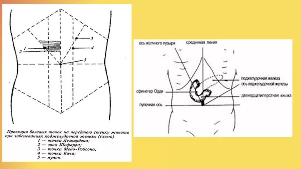 Массаж области живота. Точка Дежардена и Мейо-Робсона. Точка Дежардена, точка Мейо-Робсона. Точка Мейо Робсона и Шоффара. Точка кача и Мейо Робсона.