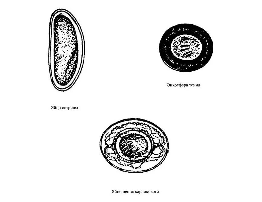 Схема исследования воды на яйца гельминтов. Строение яйца карликового цепня. Паразитология яйца гельминтов атлас. Яйца гельминтов микроскопия атлас. Яйцо с онкосферой