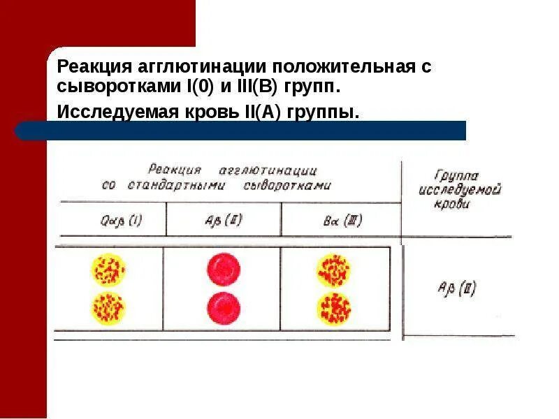 Соотношение групп крови и резус фактора. Схема группы крови резус-фактор. Кровь по резус фактору таблица. Таблица определения группы крови и резус фактора. Как обозначается резус крови