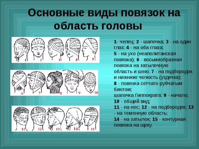 Виды повязок на ртлову. Типы бинтовых повязок на голову. Повязка на голову при травме. Типы повязок при травмах головы.