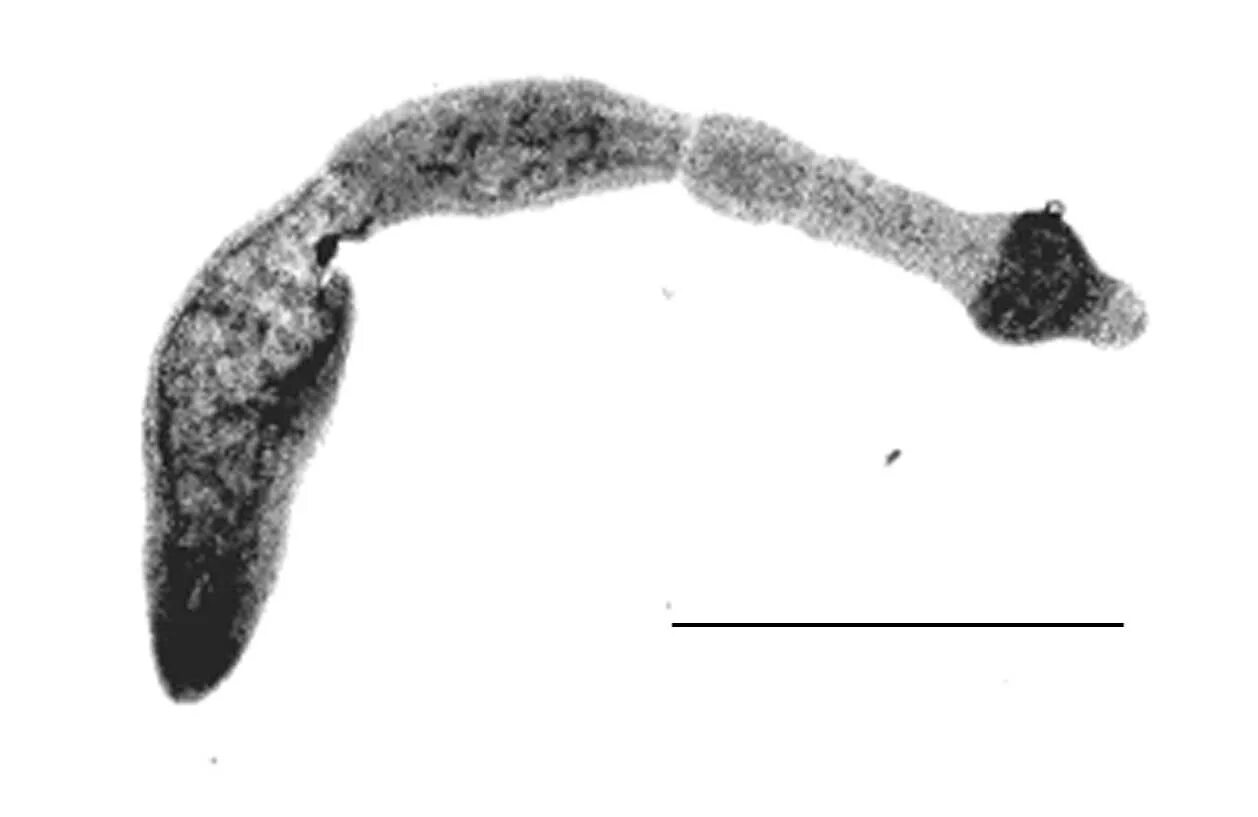 Эхинококкоз рисунок. Ленточный червь echinococcus granulosus. Эхинококкоз рисунок. Ленточные черви эхинококк. Альвеококкоз и эхинококкоз.