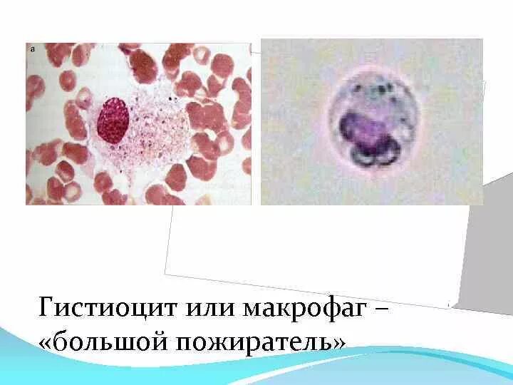 Макрофаги гистиоциты. Гистиоциты в цитологии. • Гистиоциты (тканевые макрофаги). Гистиоциты гистология. Макрофаги в тканях