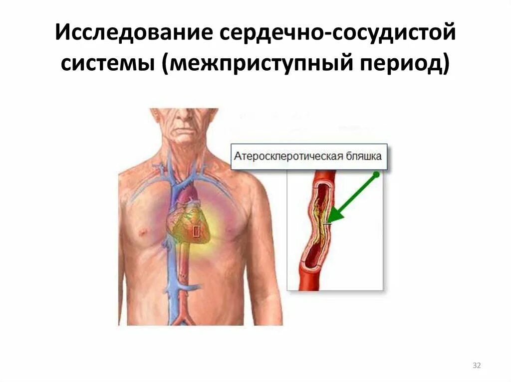 Обследование сосудистой системы