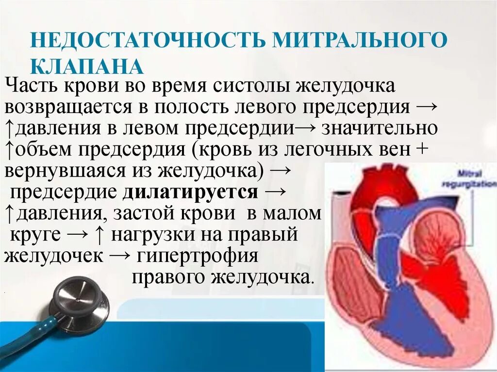 Недостаточность двустворчатого (митрального) клапана. Недостаточность створок митрального клапана. Митральный клапан сердца недостаточность 1 степени. Недостаточность митрального клапана структура.