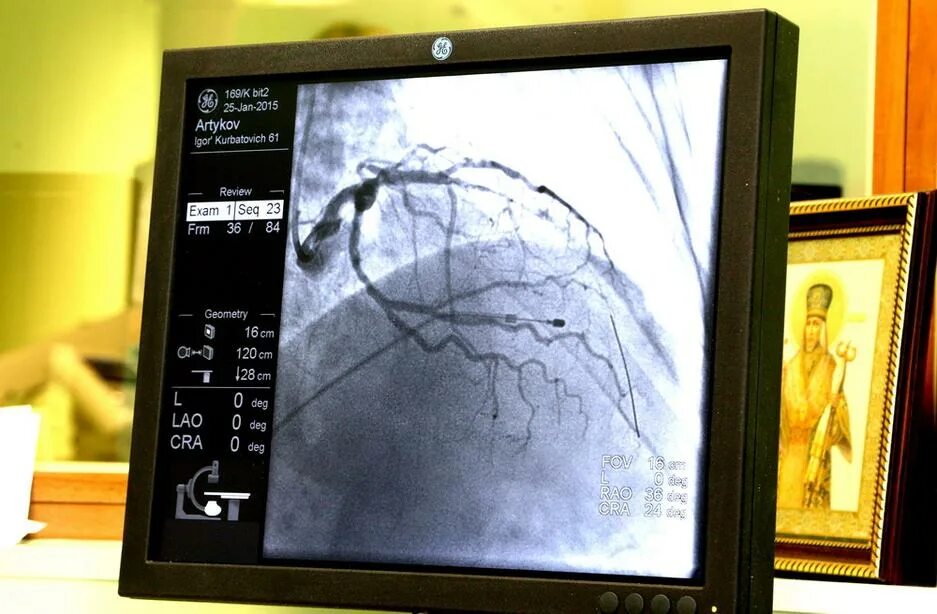 Марс в кардиологии. Белгородский кардиоцентр операции. Сердечно-сосудистая хирургия в Старом Осколе. Операция на сердце фото с монитором.
