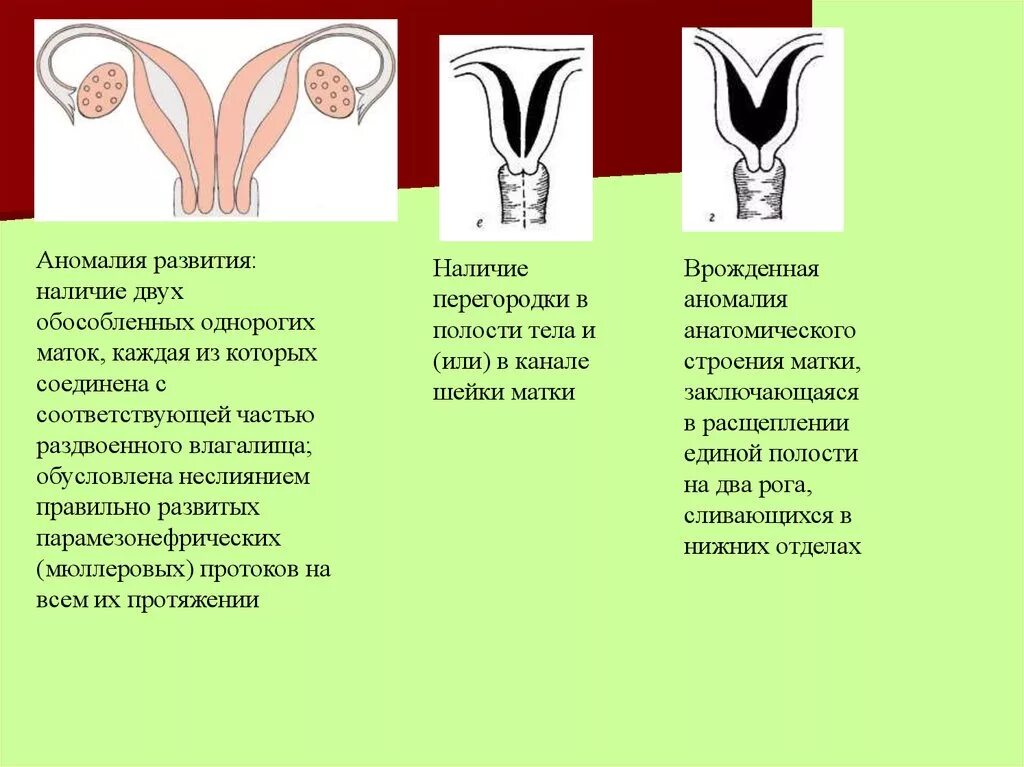 Пороки женской половой системы. Аномалии развития женских органов. Врожденные аномалии развития половых органов.