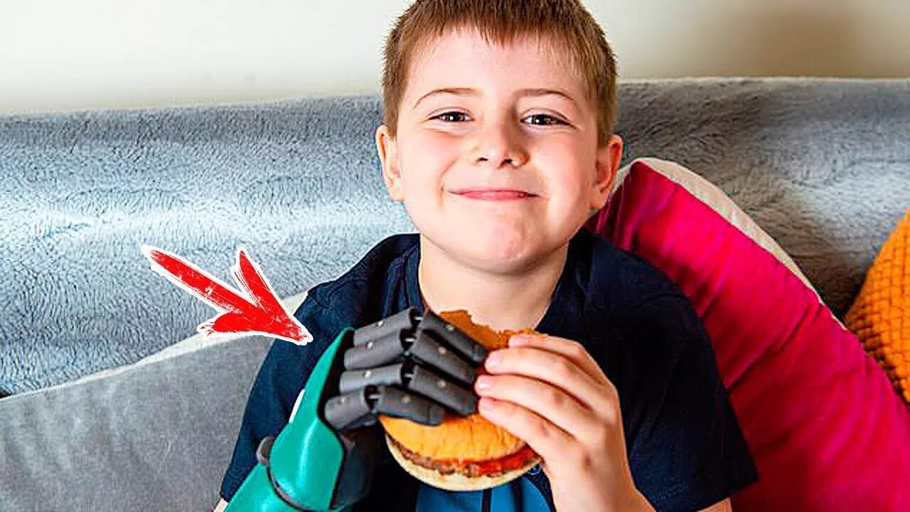 Бионические протезы. Дети с бионическими протезами. Мальчик с протезом руки. Сделать подарок десятилетнему мальчику.