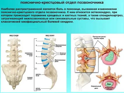 Поясничный отдел картинки