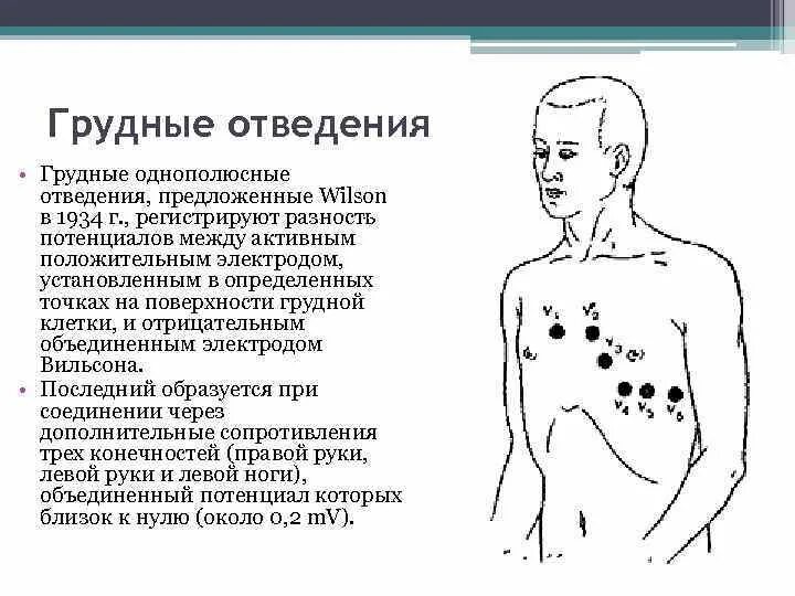 Однополюсные грудные отведения ЭКГ. Отведения Вильсона ЭКГ. Грудные однополюсные отведения по Вильсону. Расположение электродов по Вильсону. Правые грудные отведения