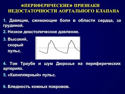 Симптомы аортального клапана