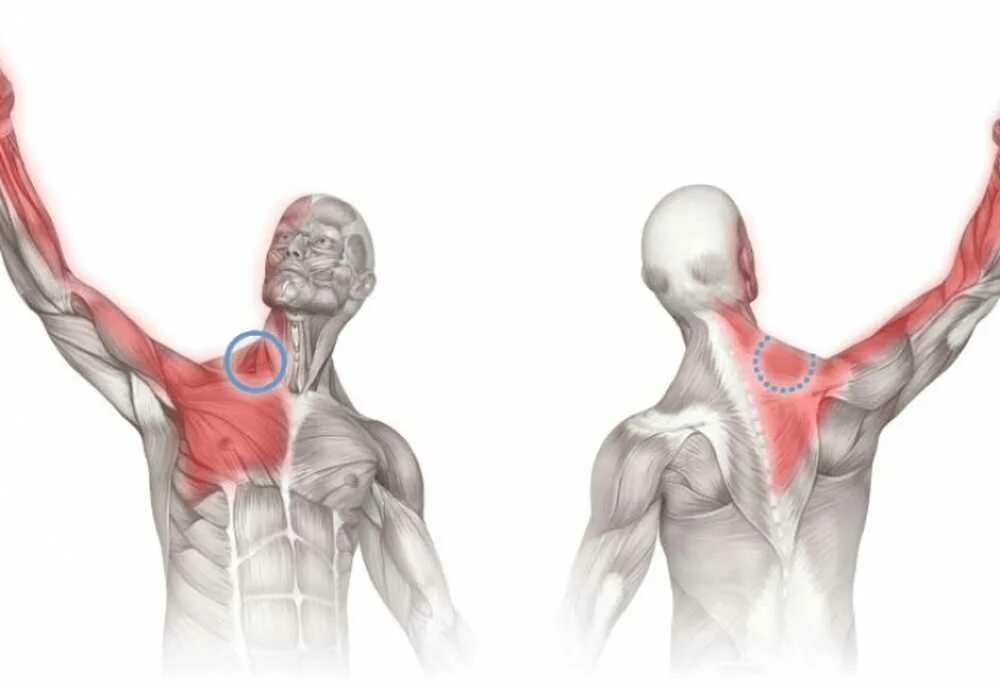 Лестничные мышцы триггерные точки. Триггерные точки в лестничных мышцах шеи. Синдром лестничной мышцы триггерные точки. Мышцы поднимающие руку. Почему плечи вверх