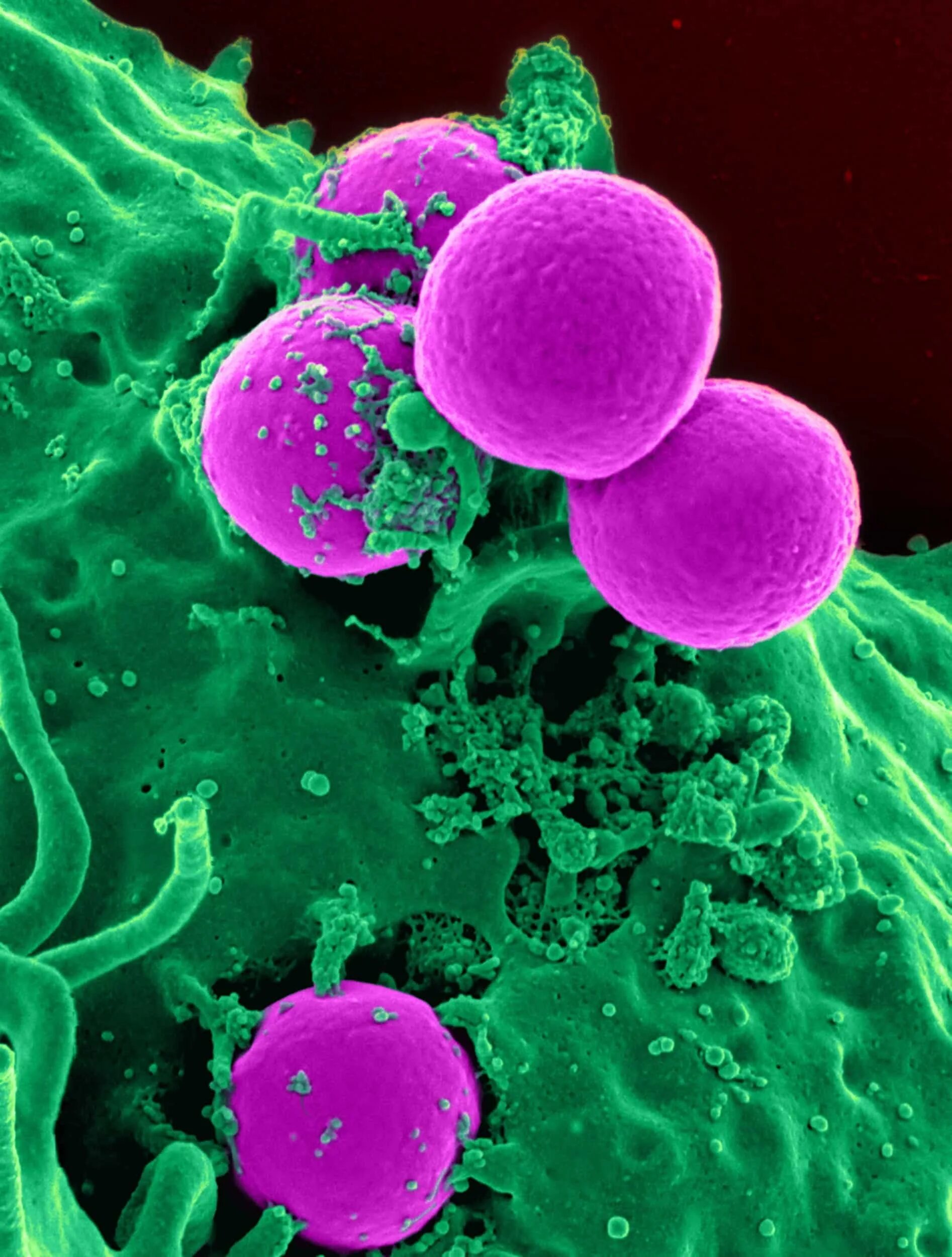 Staphylococcus pseudintermedius