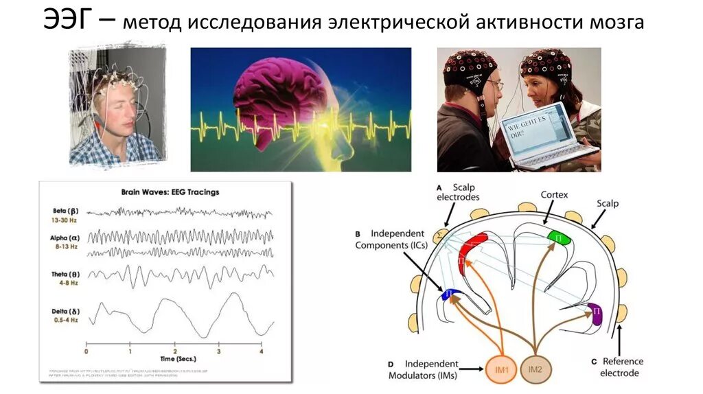 Электрическая активность мозга. Исследование активности мозга. Методы исследования электрической активности мозга. Изучение головного мозга. Неспецифические изменения мозга