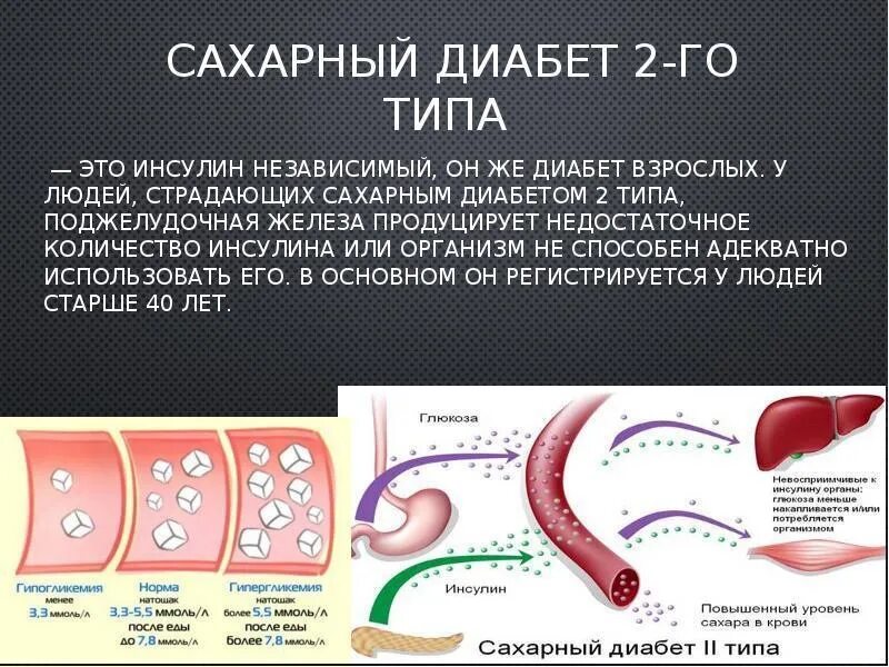Диабета ii типа. Сахарный диабет. &quot;диабет 2го типа&quot;. сахарный диабет презентация. сахарный диабет 2 типа.