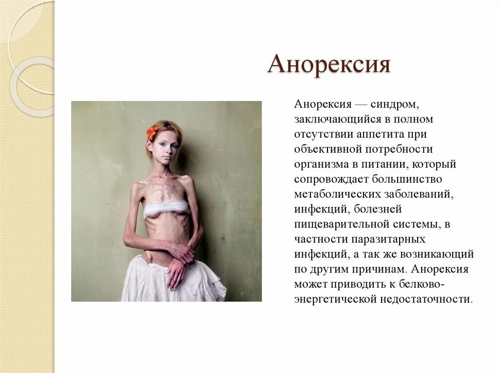 Как начинается анорексия. Как начинается анорексия