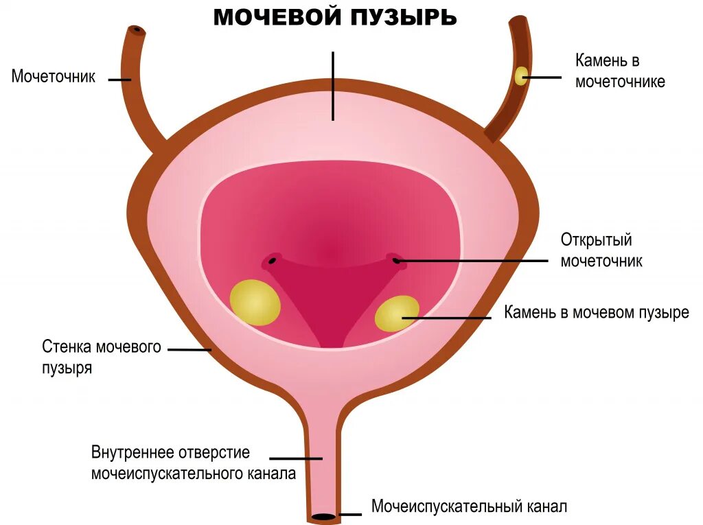 Конкремент устья мочевого пузыря. Мочевой пузырь схема. Анатомия матка и мочевой пузырь.