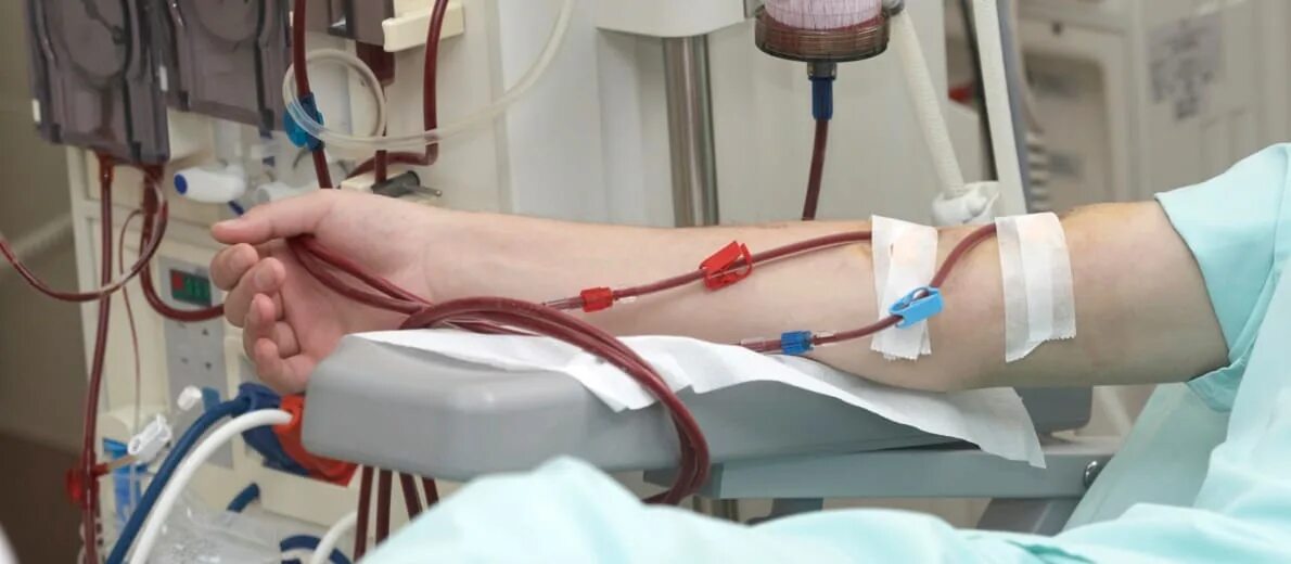 Диализ операция. Артериовенозная фистула для гемодиализа. протез фистулы для гемодиализа. фото сосудистых протезов для гемодиализа.