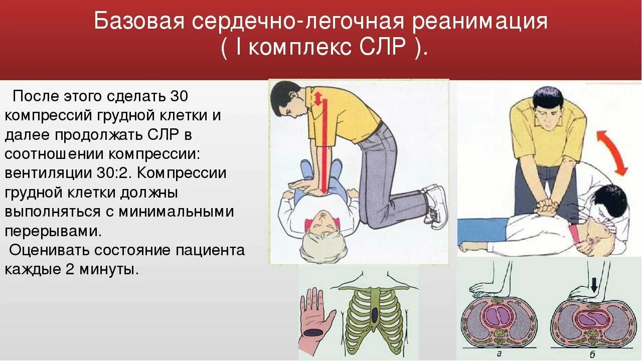 Искусственное дыхание сколько вдохов надавливаний. Сердечно-лёгочная реанимация. Базовая сердечно-легочная реанимация. Сердечно-легочная реанимация (СЛР). . Базовая сердечно – легочная реанимация (СЛР)..