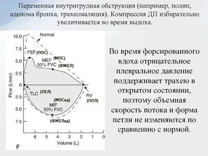 Объемная скорость выдоха
