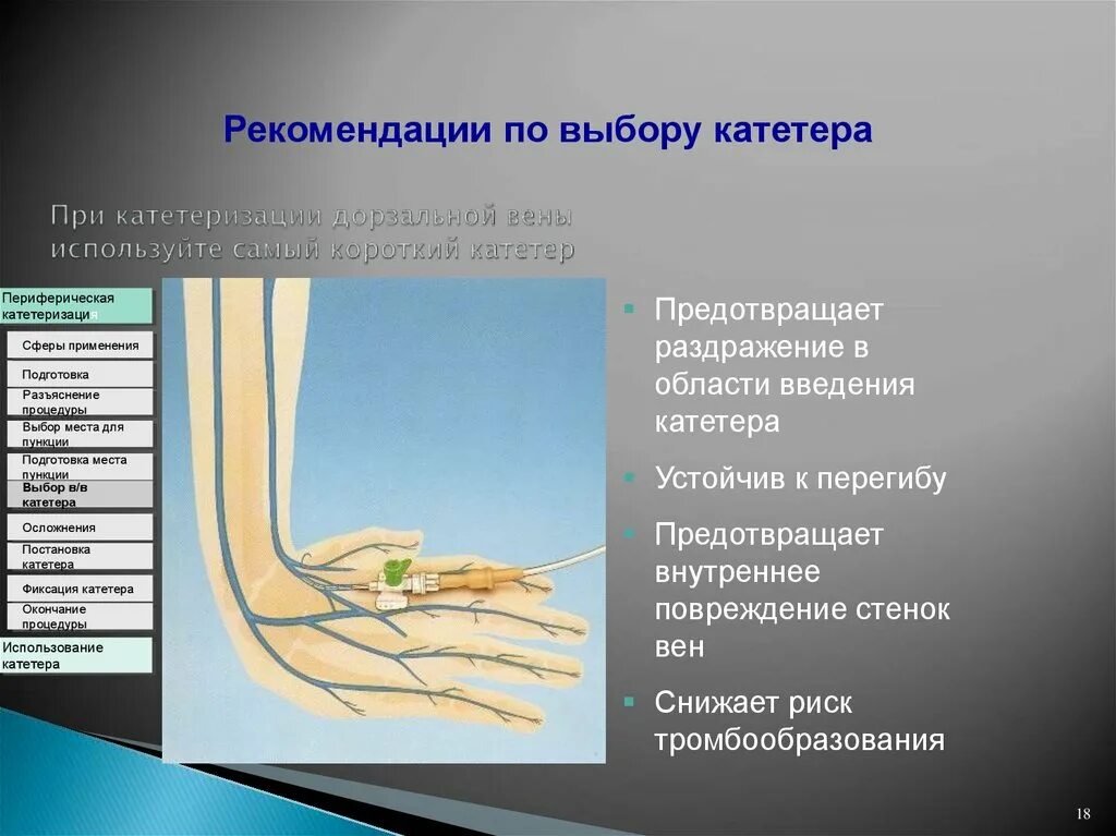 Катетеризация вен алгоритм. Места постановки катетера. Катетеризация периферических вен. Постановка периферического венозного катетера. Места постановки периферического катетера.