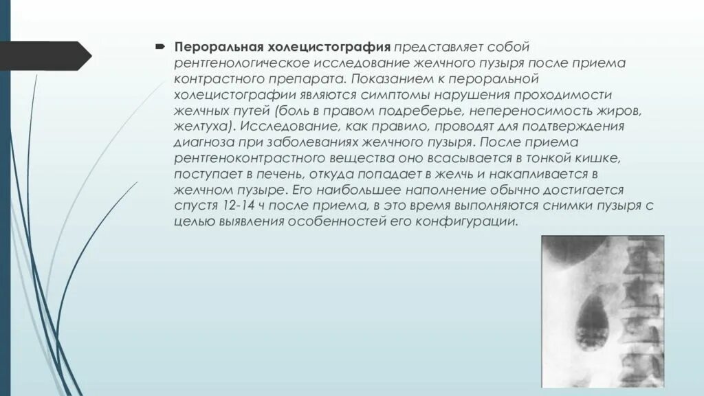 Холецистография это исследование. Холецистография полип. Холецистография это исследование. Желчнокаменная болезнь рентген. Холецистография при холецистите.